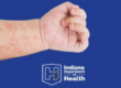 1029 measles